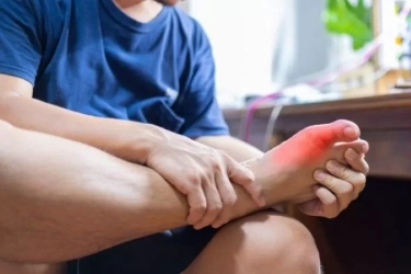 Tiga Faktor Penyebab Anak Muda Terkena Asam Urat