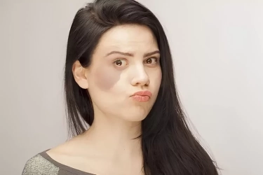 10 Macam Tanda Lahir dan Artinya, Berhubungan dengan Karakteristik hingga Keberuntungan Seseorang