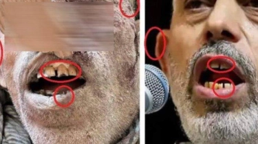 Media Israel Tunjukkan Foto Bukti Jenazah yang Meninggal Adalah Pemimpin Hamas Yahya Sinwar