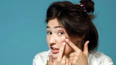 Cara Efektif Merawat Kulit Berminyak dan Mencegah Jerawat, dr. Amelica Oksariani Beri Penjelasan