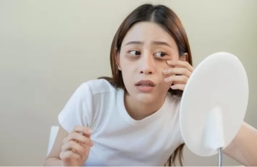 5 Kebiasaan yang Menyebabkan Mata Panda, Selain Mengganggu Penampilan Dapat Mempengaruhi Mental dan Emosi 
