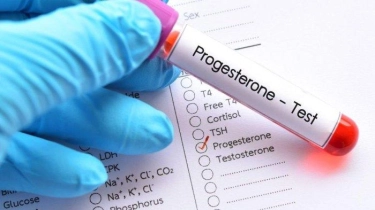 5 Masalah yang Bisa Muncul Jika Kadar Hormon Progesteron Terlalu Rendah