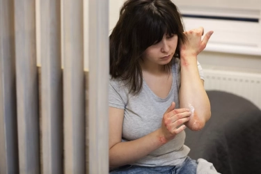 Psoriasis Bukan Hanya Penyakit Kulit, Kenali Gejala, Penyebab, hingga Cara Pengobatannya