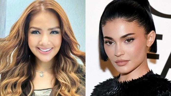 Rela Rogoh Kocek Miliaran Rupiah, Barbie Kumalasari Lakukan Operasi Plastik agar Mirip Kylie Jenner