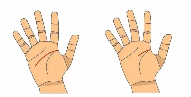 Anda Punya Garis Kepala Panjang atau Pendek? Simak Makna dan Ciri Kepribadian di Balik Telapak Tangan Anda