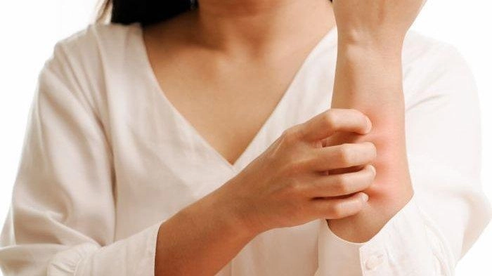 Polusi Udara Berdampak pada Kesehatan Kulit, Memperburuk Penyakit Kulit yang Sudah Diderita
