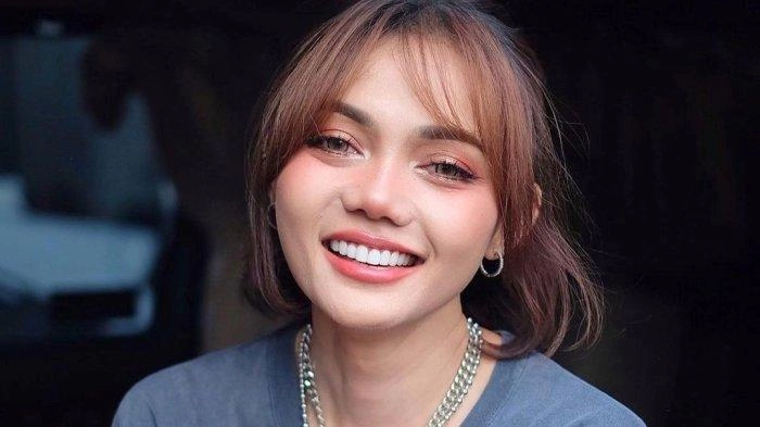Rina Nose Ceritakan Asal-usul Nama Panggungnya, Berawal dari Ejekan Sule