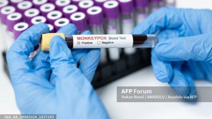 WHO Masukkan Vaksin LC16m8 Mpox Dalam Daftar Penggunaan Darurat