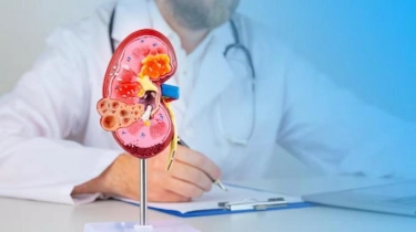 Benarkah Pijat Bisa Menyembuhkan Batu Ginjal? Ini Kata Dokter