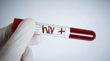 Cegah Penularan HIV Dokter Sarankan Hindari Seks Bebas dan Penggunaan Jarum Suntik Bekas
