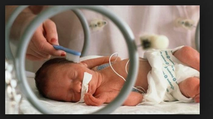 Bayi Prematur Berisiko Terkena Infeksi Virus RSV, Penyebab Bronkiolitis dan Pneumonia
