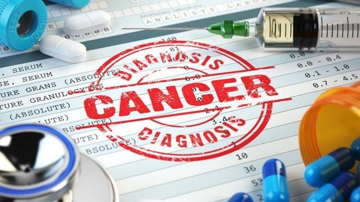 Hati-Hati, Kurang Makan Serat Bisa Berujung Kanker Usus Besar, Begini Penjelasan Dokter
