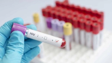 Apakah Orang dengan HIV Bisa Menikah dan Punya Anak? Ini Kata Dokter