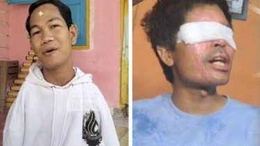 Beda Kasus Agus Salim dengan Agus Buntung yang Tengah Disorot Publik