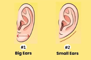 Tes Kepribadian: Bentuk Telinga Kamu Ungkap Berbagai Karakter dan Potensi Karier, Ini Penjelasannya!
