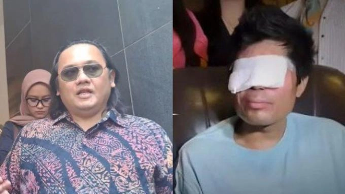 Farhat Abbas Singgung soal Donasi Agus Salim yang Dialihkan ke NTT: Itu Uang Sengketa