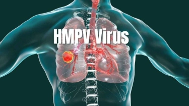 Tubuh Terpapar Virus HMPV, Ini Langkah Penanganannya 