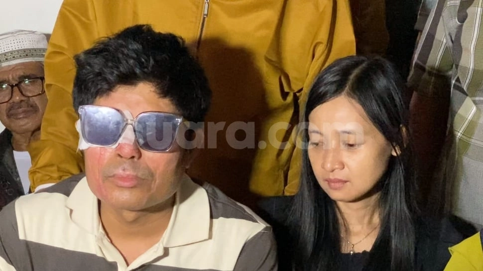 Ngotot Kejar Donasi Rp1,3 Miliar, Gaya Istri Agus Salim saat Datangi Polda Bikin Salfok