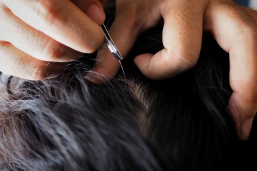 Bolehkah Mencabut Uban karena Gatal? Berikut Penjelasannya…