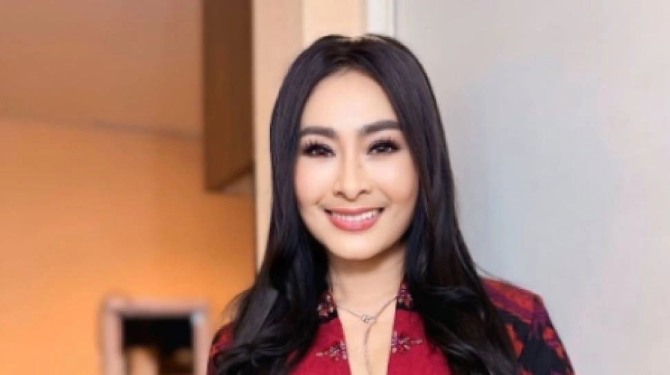 Segini Kekayaan Iis Dahlia yang Facelift Gratis di Korea, Hobi Koleksi Berlian