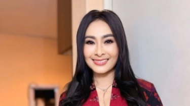 Segini Kekayaan Iis Dahlia yang Facelift Gratis di Korea, Hobi Koleksi Berlian