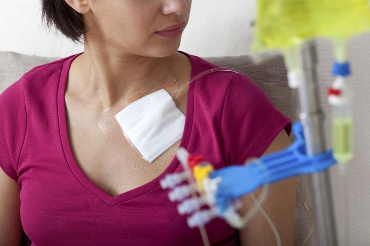 Apa Efek Samping Setelah Kemoterapi? Ini 13 Daftarnya...