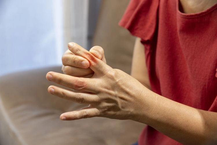 Bagaimana Cara Menurunkan Asam Urat dengan Cepat? Ini 10 Daftarnya…