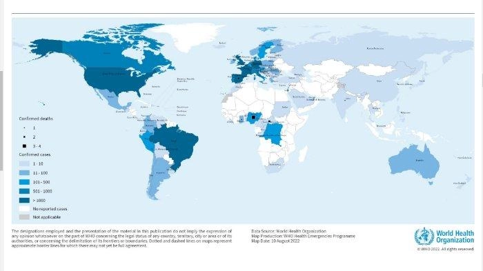 Cacar Api Bisa Sebabkan Nyeri Saraf Bertahun-Tahun, Ini Penjelasan Ahli