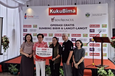 Donasikan Rp 260 Juta, Kuku Bima Sido Muncul Gelar Operasi Bibir Sumbing di Lebak