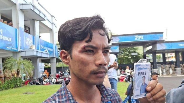Kecam Aksi Pemukulan Jurnalis Tribun, Iwakum Desak Aparat Proses Hukum Oknum Satpol PP Ternate