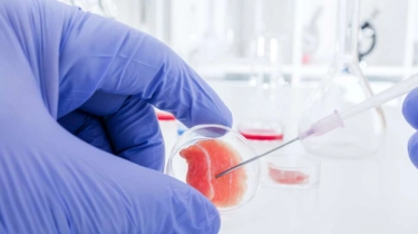 Terobosan Medis 2025: Pengobatan Revolusioner untuk Kanker, Jantung, dan Parkinson di Depan Mata