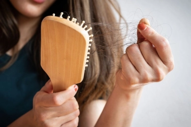 3 Tips Merawat Rambut Rontok, Mulai Gaya Hidup Sehat