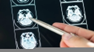 5 Fakta Menarik Khasiat Akar Bajakah untuk Kanker