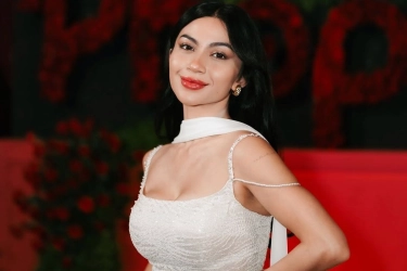 Ariel Tatum Akui Pernah Alami Masalah Kulit Belang, Begini Cara Mengatasinya