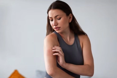Banyak Diderita Perempuan Muda, Ini Penyebab Lupus