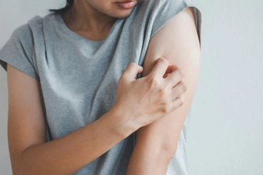 Benarkah Stres Bisa Menyebabkan Gatal dan Biduran?