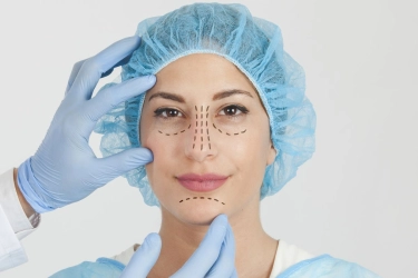 3 Jenis Operasi Plastik Hidung, dari Silikon hingga Tulang Rawan