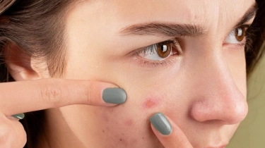 Dikira Aman, Bahan Alami Ini Ternyata Berbahaya untuk Wajah Menurut Dokter Kulit