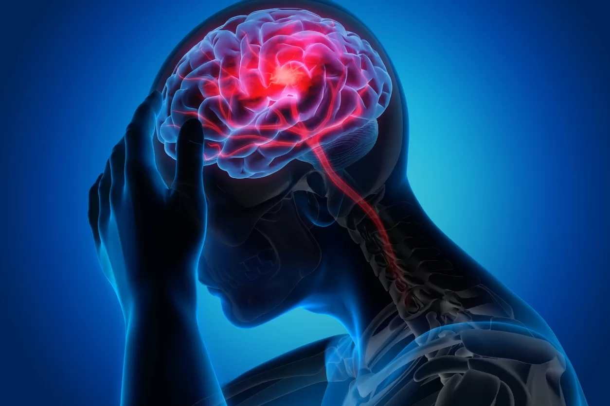 Rehabilitasi Pasca Stroke, Kembali Mandiri dengan Pendekatan Holistik