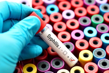 20 Ribu Lebih Orang Indonesia Terkena Sifilis, Kenali Ini Gejalanya…