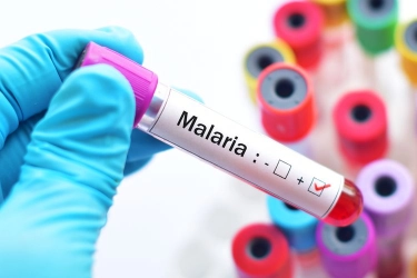 79 Persen Wilayah Indonesia Bebas Malaria, Menkes Optimistis Eliminasi Kasusnya