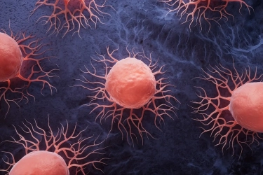 Studi: Tes Darah Ini Bisa Deteksi Kanker Tiga Tahun Sebelum Diagnosis