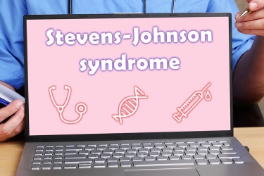 Alami Stevens Johnson Syndrome, Apakah Bahaya?