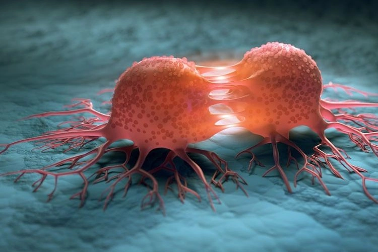 Alat Tes Deteksi Dini Kanker Asal Jepang Tunjukkan Hasil Menjanjikan