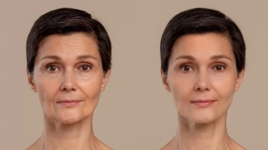 Memengaruhi Penampilan Anda, Inilah 7 Penyebab Penuaan Dini yang Jarang Disadari dan Harus Diwaspadai