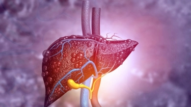 Awas Aflatoksin! Senyawa Penyebab Kanker Hati yang Sering Terabaikan di Dapur Anda