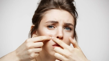 5 Rekomendasi Moisturizer Penghilang Flek Hitam, Ampuh Cerahkan Wajah Mulai Rp30 Ribuan