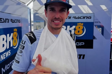 Alex Marquez Cedera Tulang Metakarpal Kedua, Diragukan Bisa Tampil di Seri MotoGP Jerman