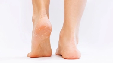 10 Rekomendasi Krim Kaki Terbaik (Foot Cream) untuk Kulit Kering dan Kapalan