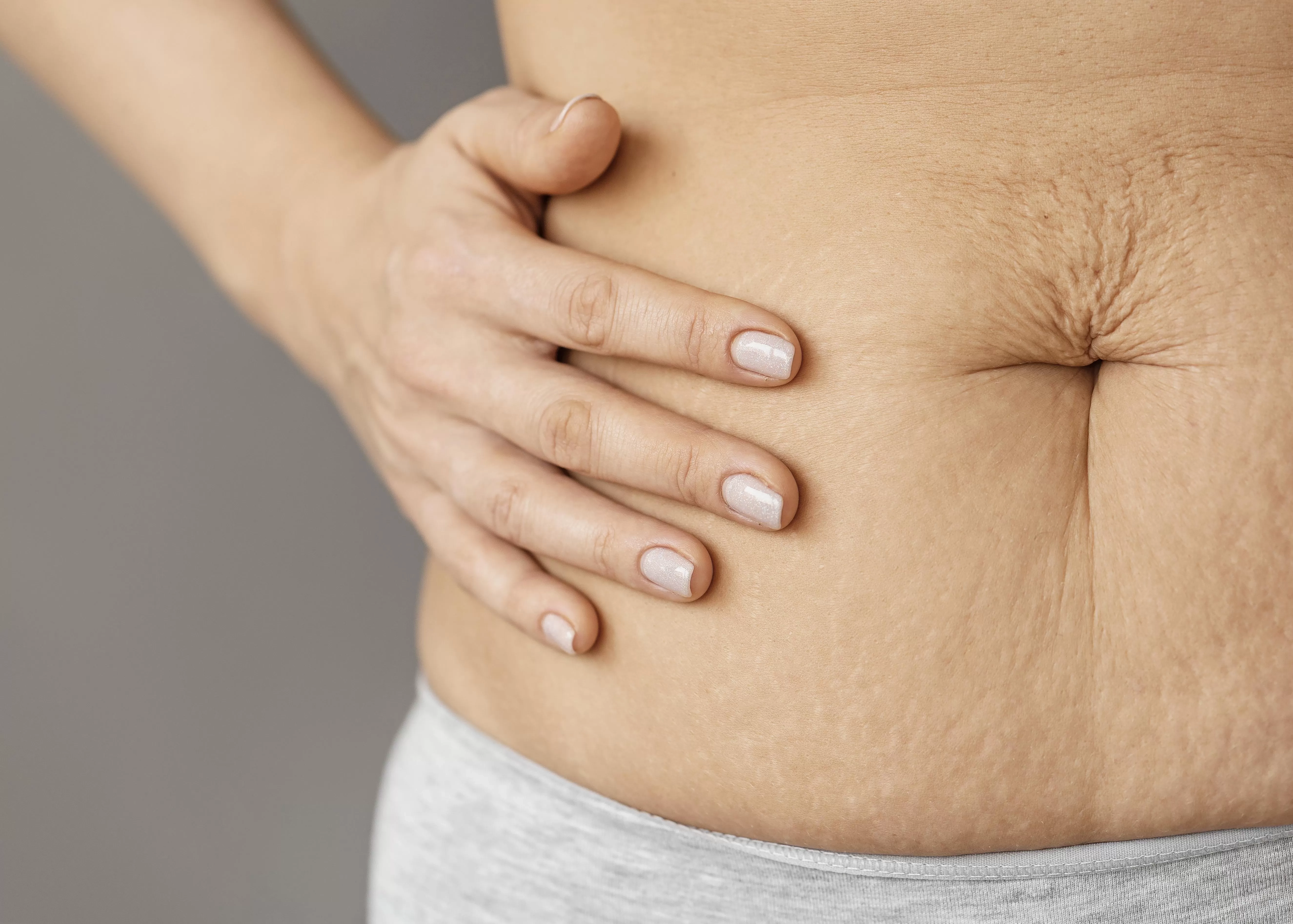 Gunakan 5 Bahan Alami Ini untuk Bantu Mempercepat Hilangkan Stretch Mark secara Efektif